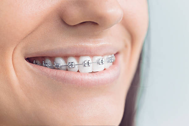 Dental Inlays and Onlays in Mojave, CA